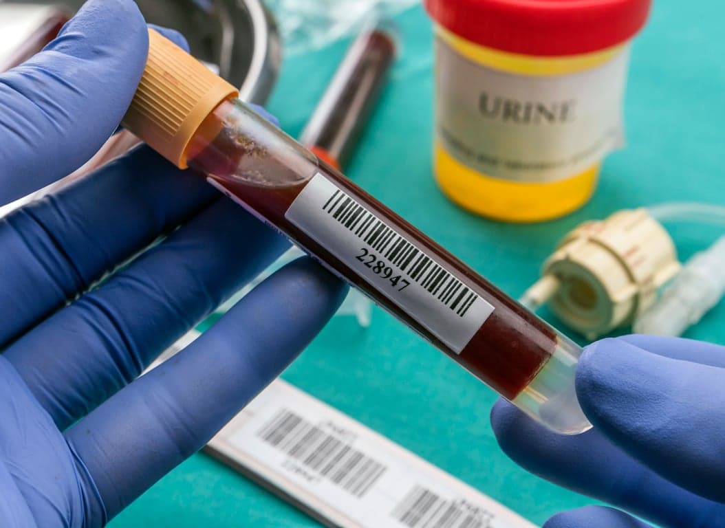 doctor holds blood sample at a hospital table