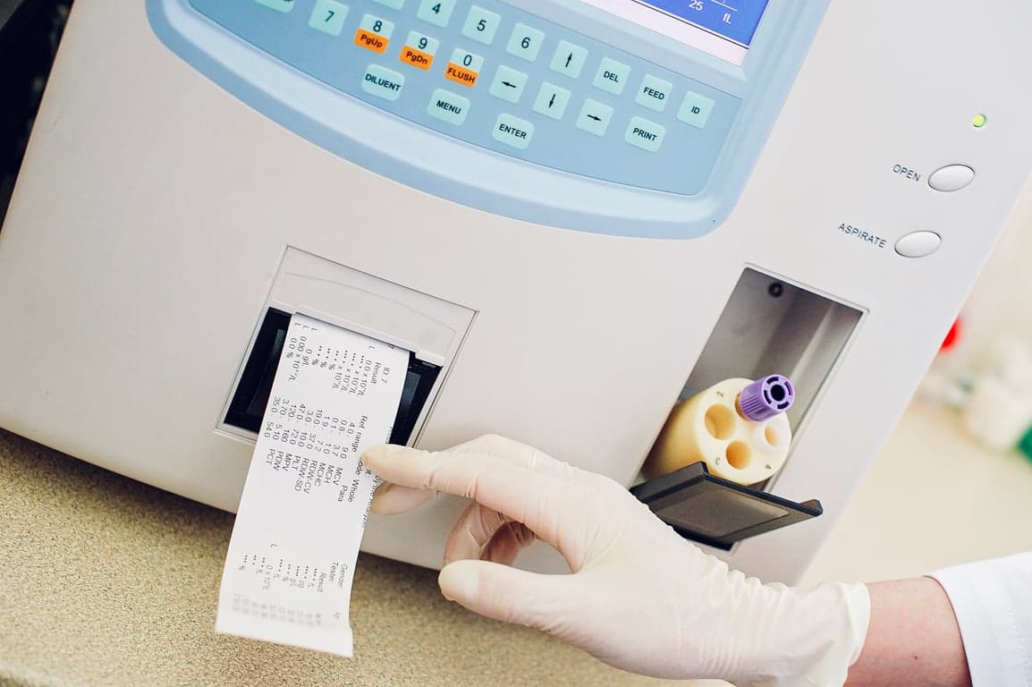 lab machine prints patient blood test results