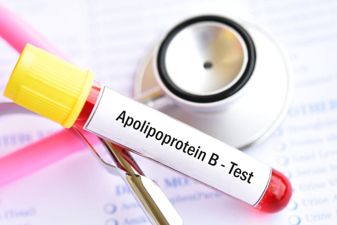 Blood sample for an Apolipoprotein B (ApoB) blood test to evaluate heart disease and cholesterol risk.