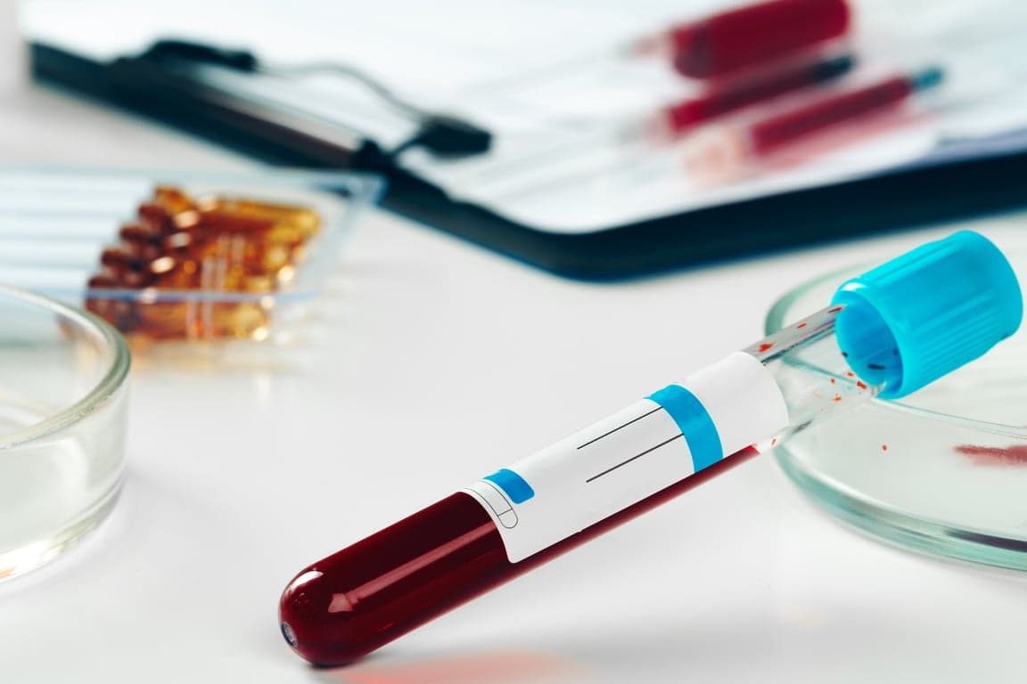 close up of test tubes arranged on a table in medi
