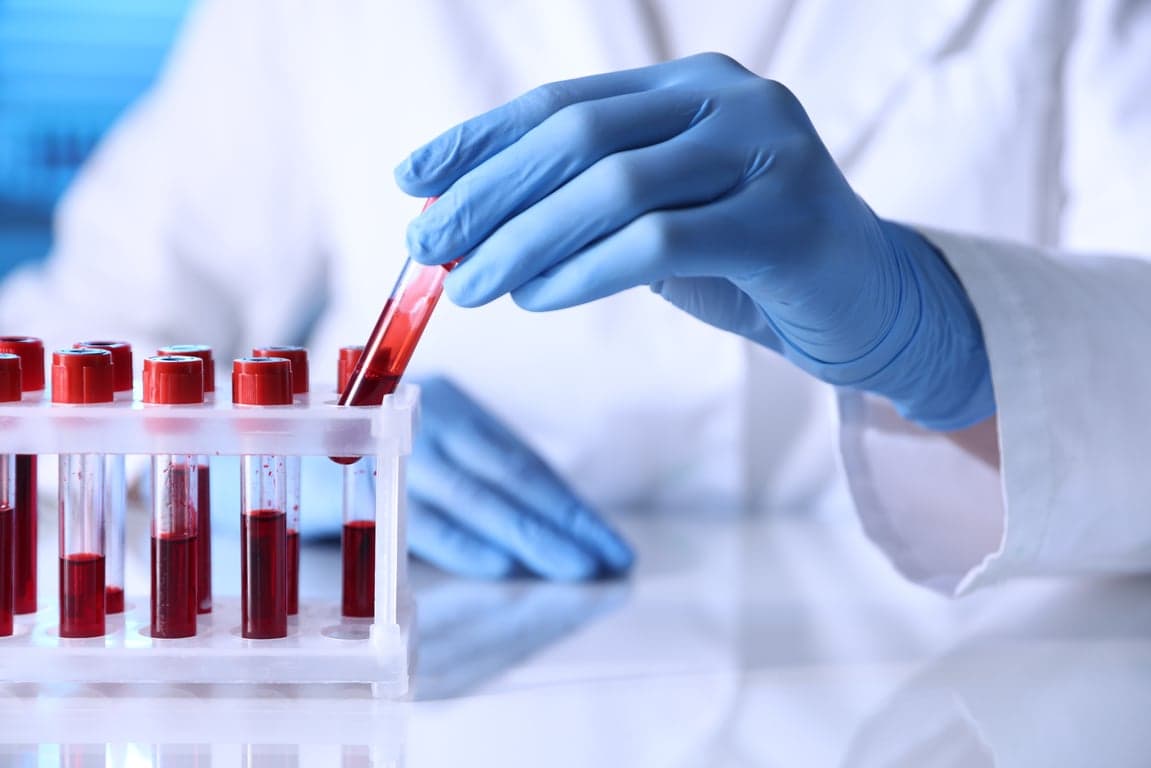 laboratory technician handling blood samples