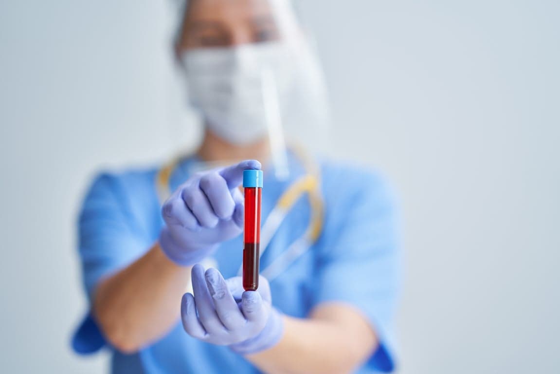 medical professional holding blood sample in test