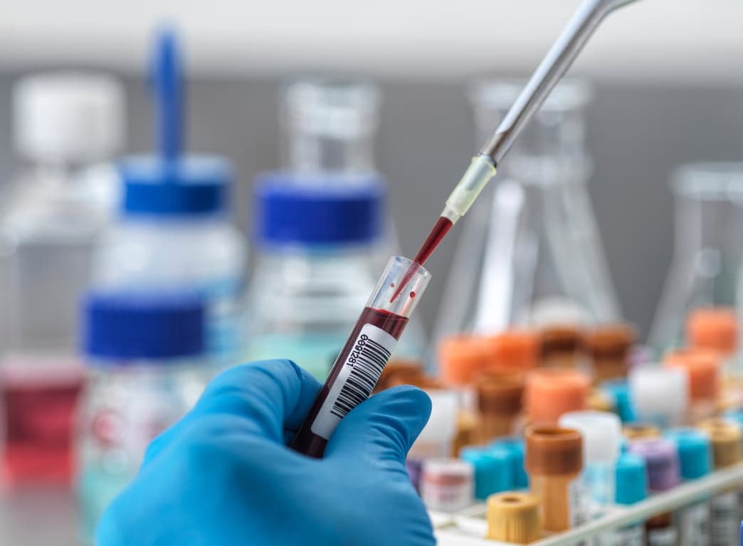 Illustration of a blood test tube labelled ALP with liver and bone icons showing the two main sources of alkaline phosphatase