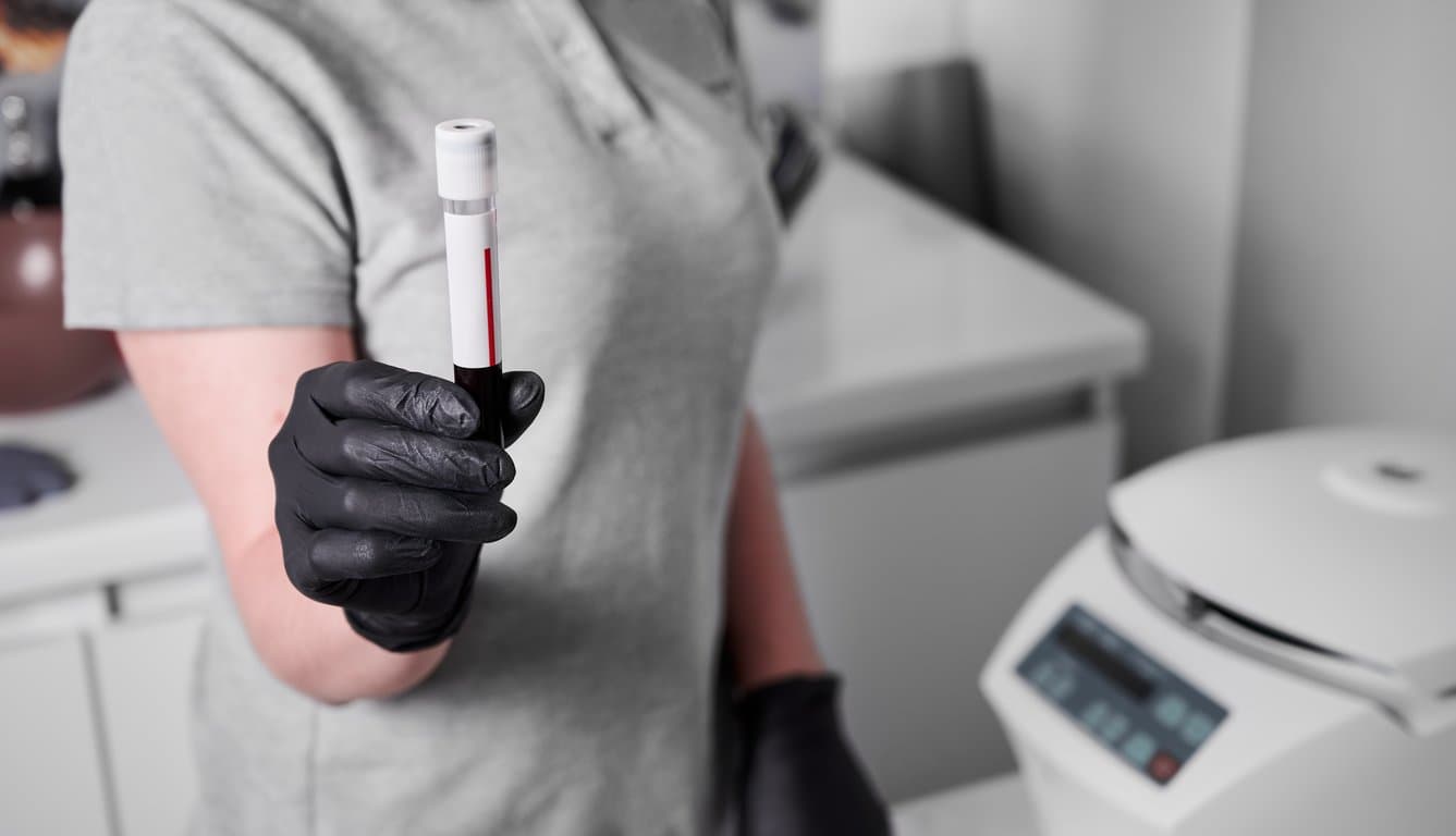 medical professional holding blood sample in labor