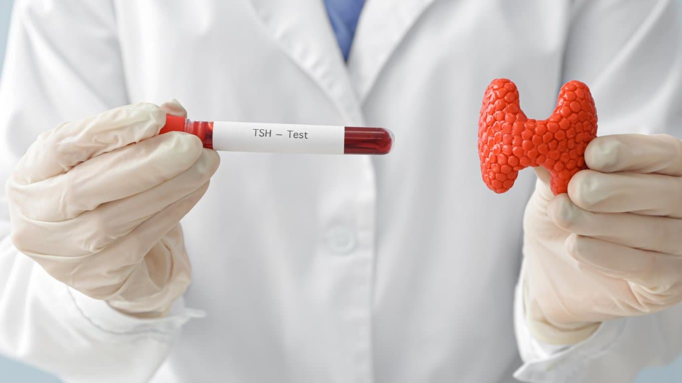 Illustration of a thyroid gland with antibodies binding to TSH receptors, representing a thyroid stimulating immunoglobulin (TSI) blood test