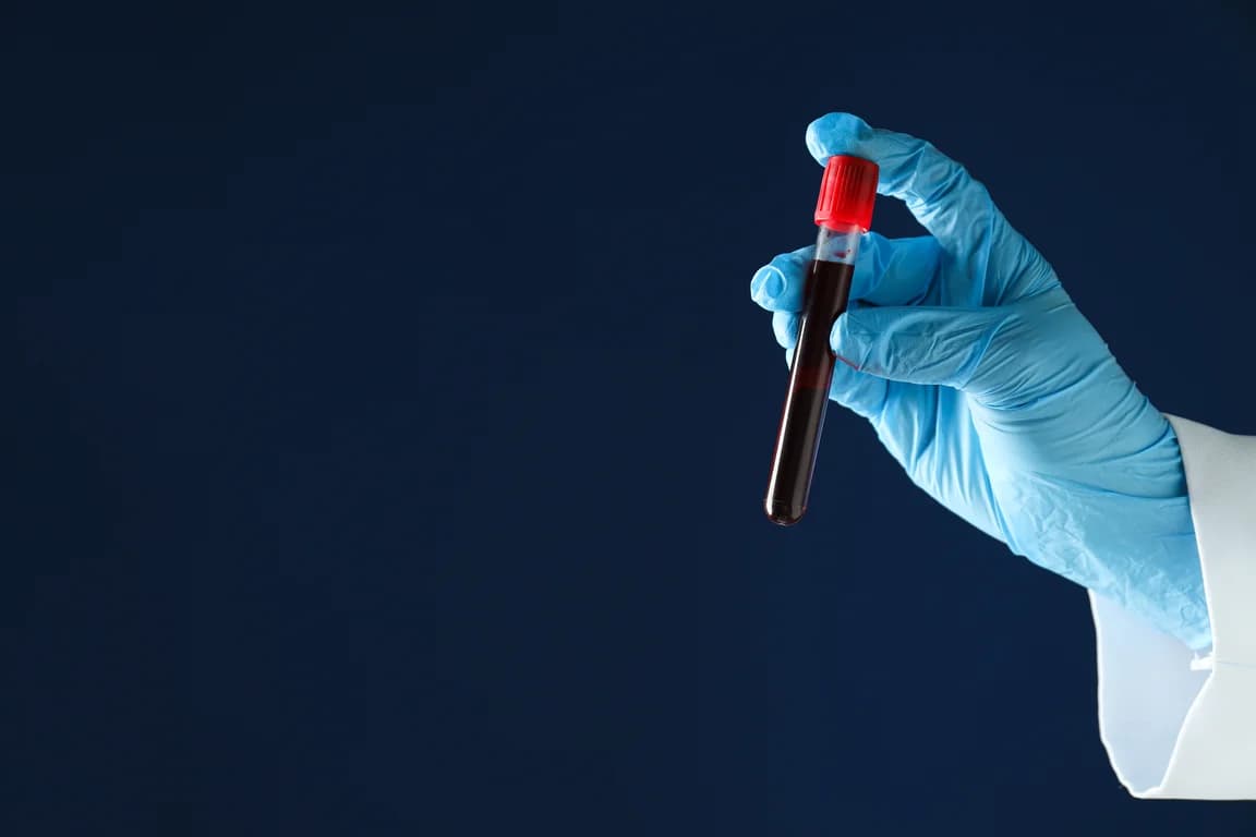 blood sample in a test tube in lab